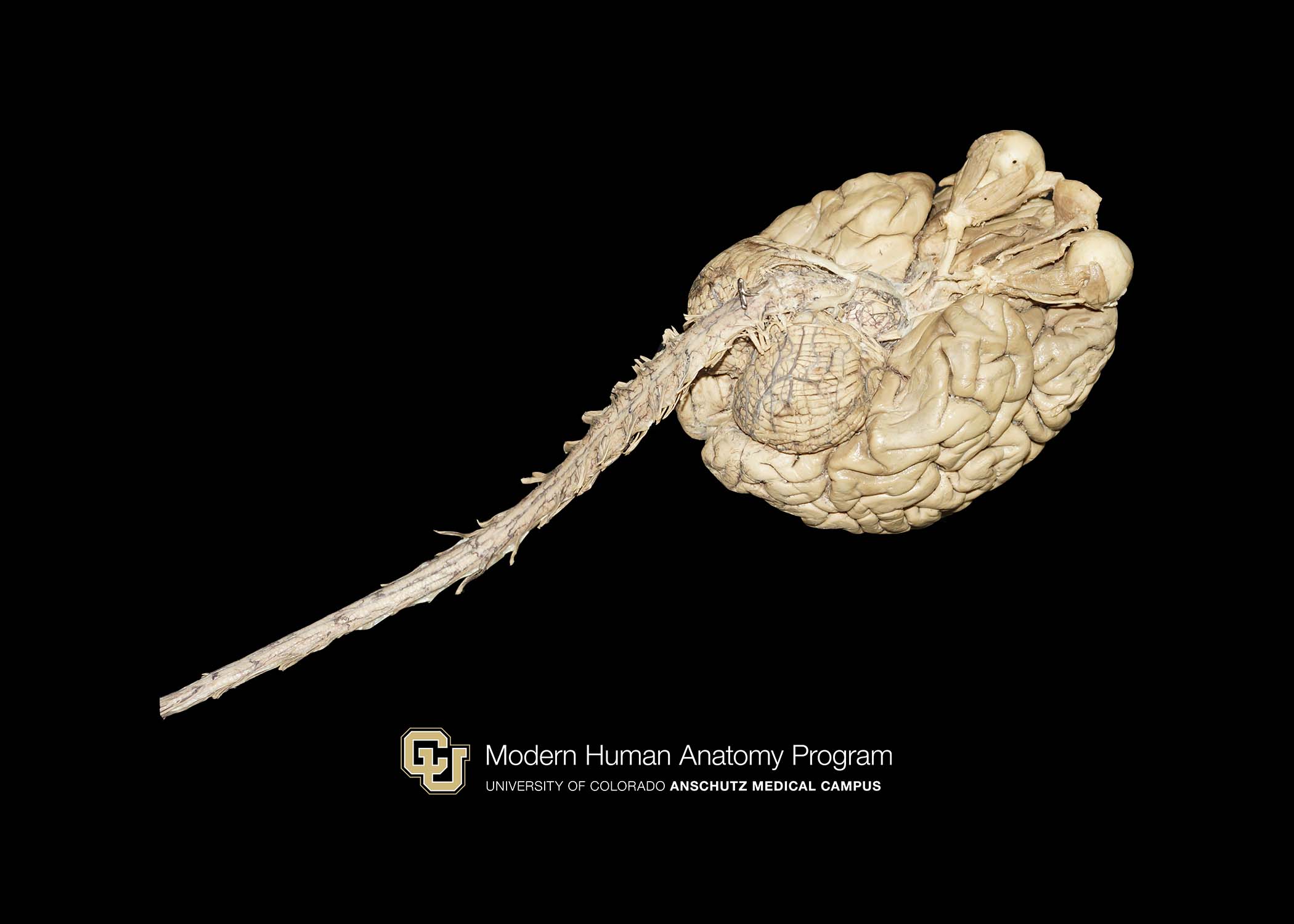 CU Plastinated Organ Library